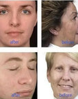 Theia Pro 9-in-1 Korean Hydra Facial Machine