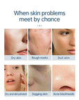 Theia HydraPro 6-in-1 Microdermabrasion Facial Machine