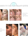 Theia HydraPro 6-in-1 Microdermabrasion Facial Machine