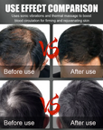 Theia Plus Hair Regrowth Laser Cap 150 Leds 660nm 850nm