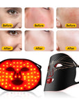 Theia OmegaGlow LED light Therapy Mask