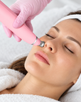 Portable Diamond Microdermabrasion Facial Device