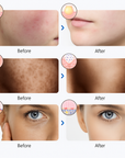 The Ultimate Glow Mask: 7-Color LED Therapy