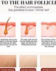 Professional 3-Wavelength 808nm Diode Laser Hair Removal Machine