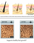 Anti Hair Loss Growth Serum