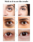 Hyaluronic Acid Micro-Needle Eye Patch