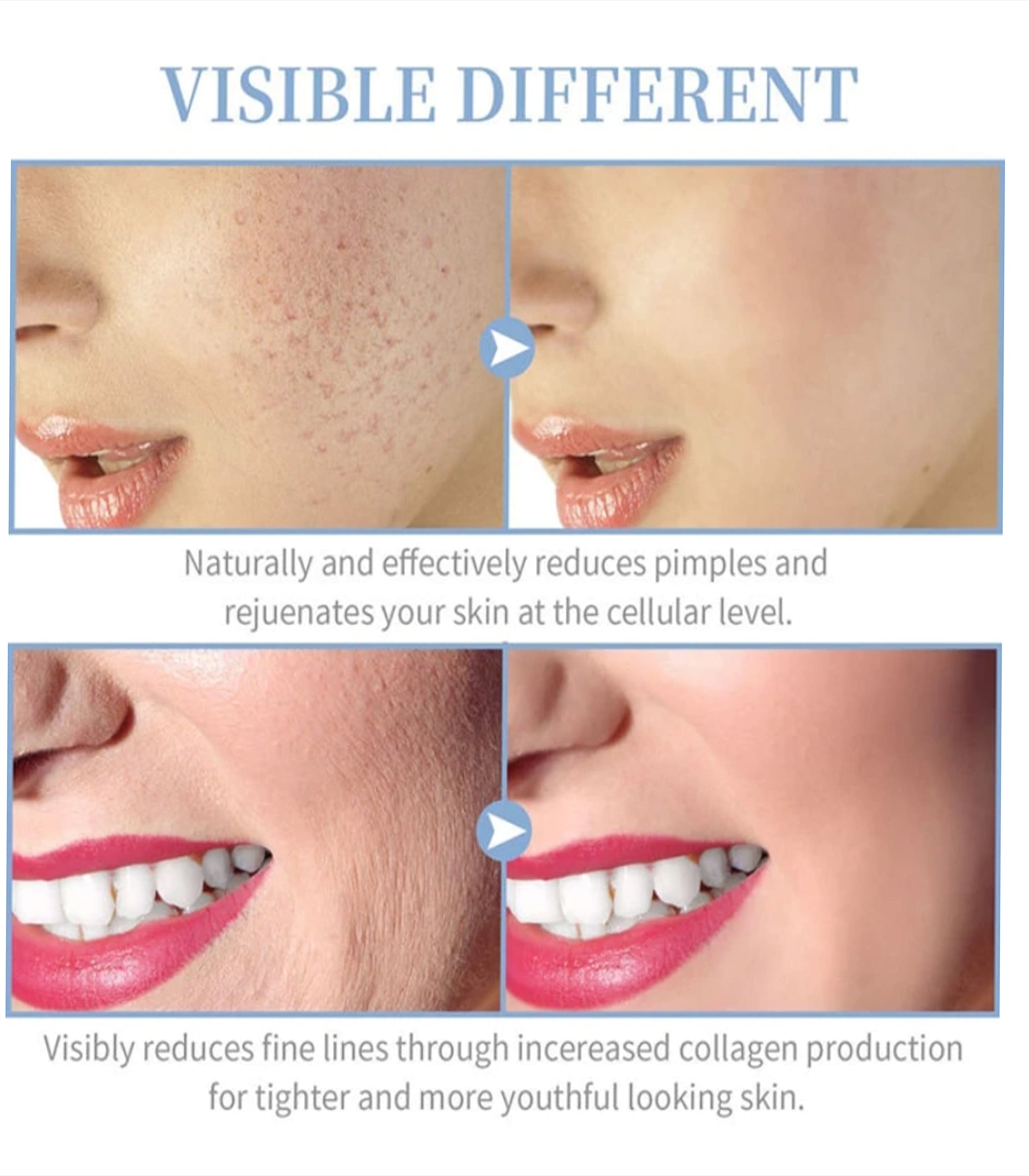 Theia Professional Skin Therapy Wand