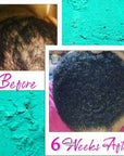Anti Hair Loss Growth Serum