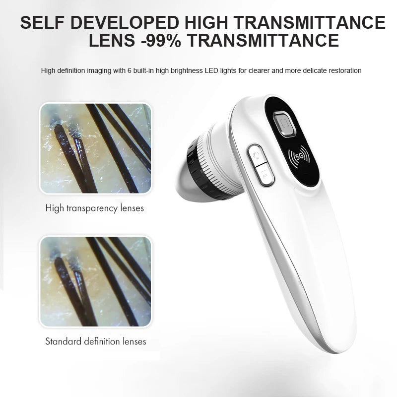 THEIA SmartScope Pro Wireless HD Skin, Scalp & Hair Follicle Analyzer – Professional 1080P Skin Analysis System