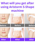 Ultimate Aristorm S Shape Machine – 30K Ultrasound Body Sculpting & Facial Lifting Device