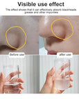 Hydrogen Oxygen Small Bubble Hydra Aqua Peeling Beauty Machine Face Lifting Dermabrasion Skin Scrubber Salon Facial Spa Device