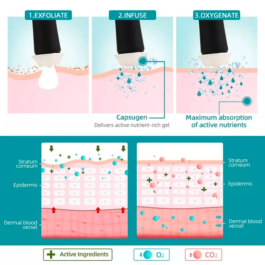 Oxy GenX3 In 1 Ultrasonic RF Oxygen Facial device Skin Care CO2 Oxygen Bubble Exfoliate Oxygen Jet Peel Facial Machine