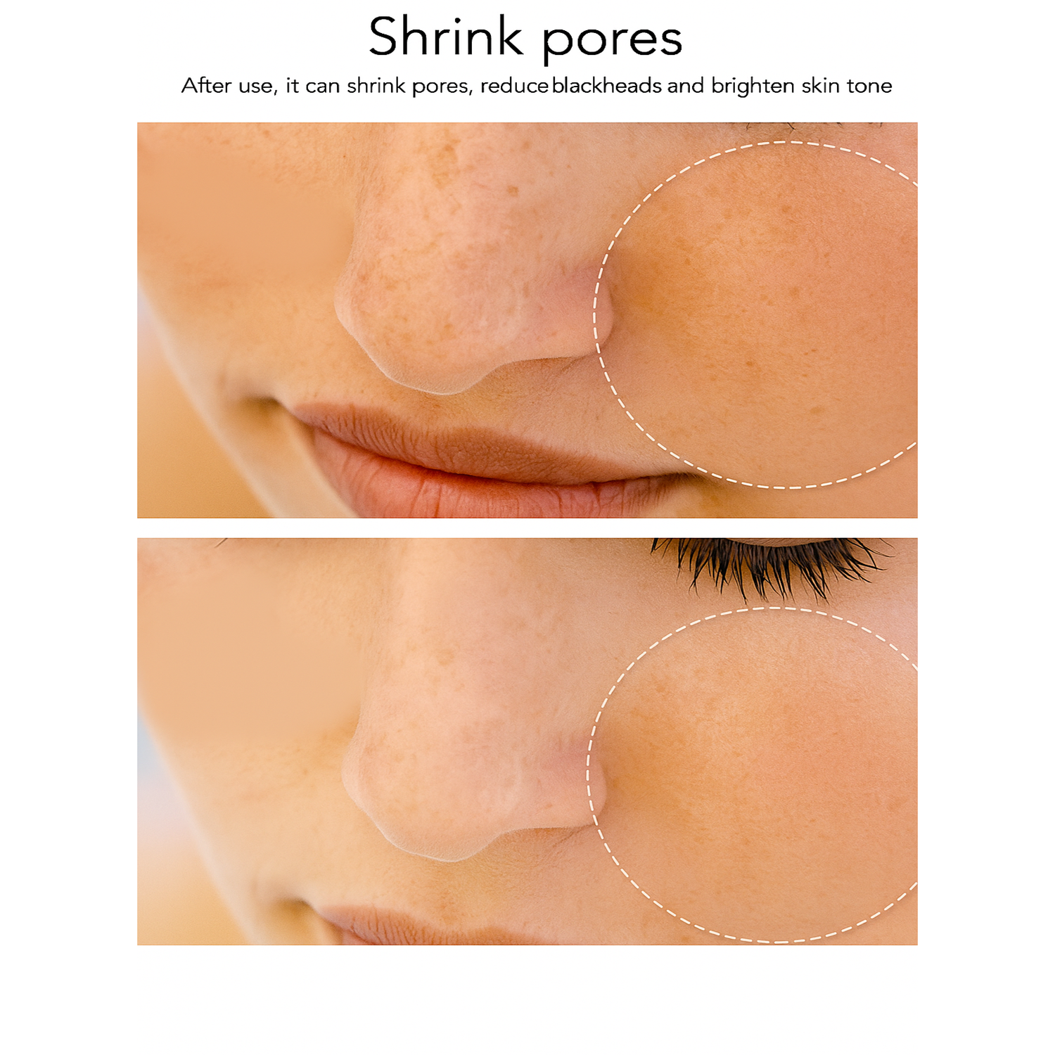 Theia RF – Professional Radio Frequency Facial Lifting & Skin Rejuvenation Device