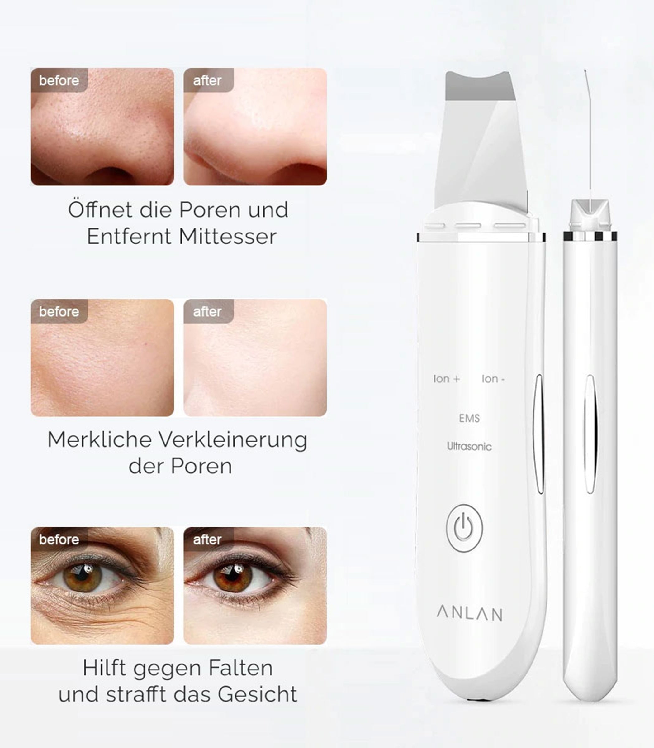 Ultrasonic Ion Skin Scrubber