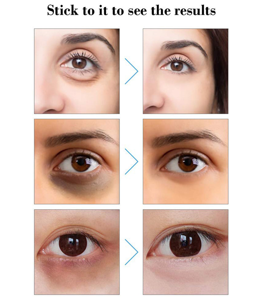 Hyaluronic Acid Micro-Needle Eye Patch 5 Boxes (10 PCS )
